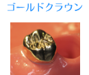 ゴールドクラウン