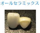 オールセラミックス